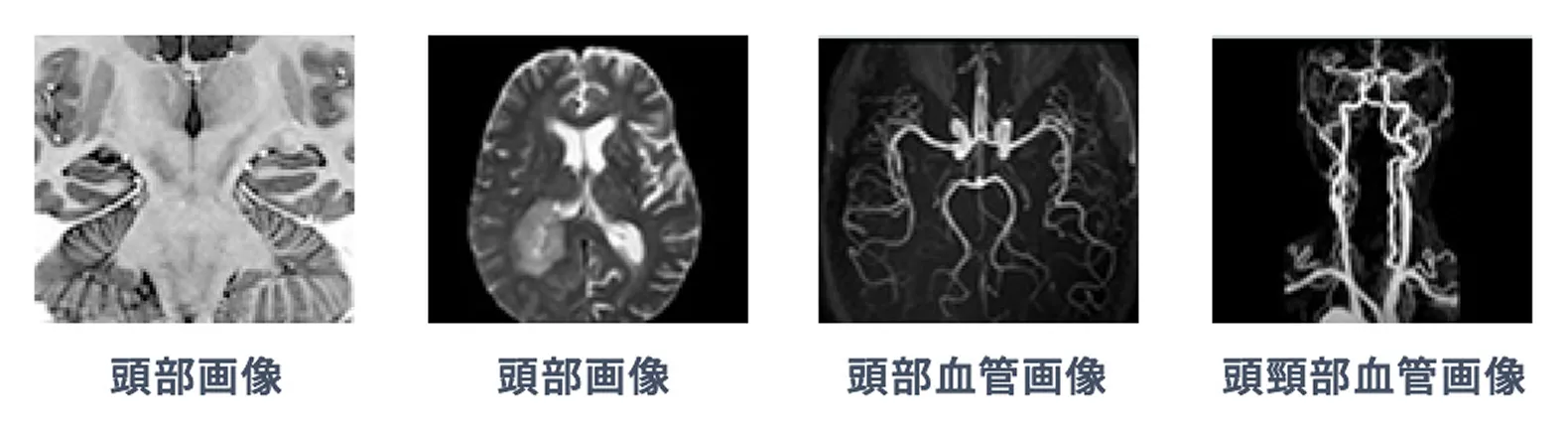 MRI検査画像サンプル（頭部画像、頭部血管画像、頭頸部血管画像）